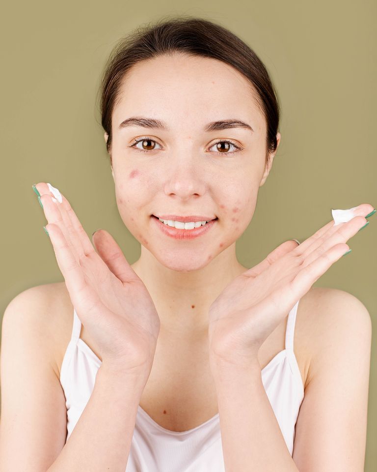 éviter l'effet rebond et l'acné après l'été