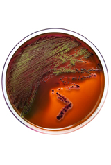 Epidémie d'E.coli : des graines germées bio responsables